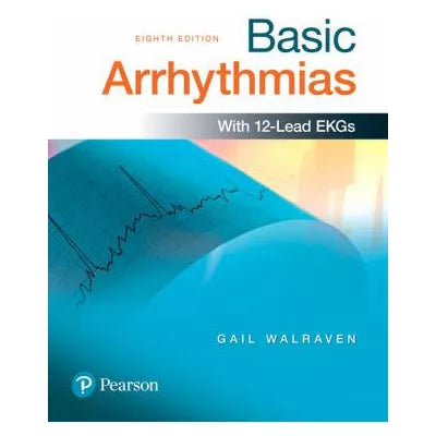 Basic Arrhythmias
